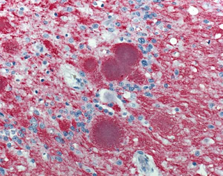 Illustration for article titled Why Some Diseases Wait in Your Body For Decades Before Striking
